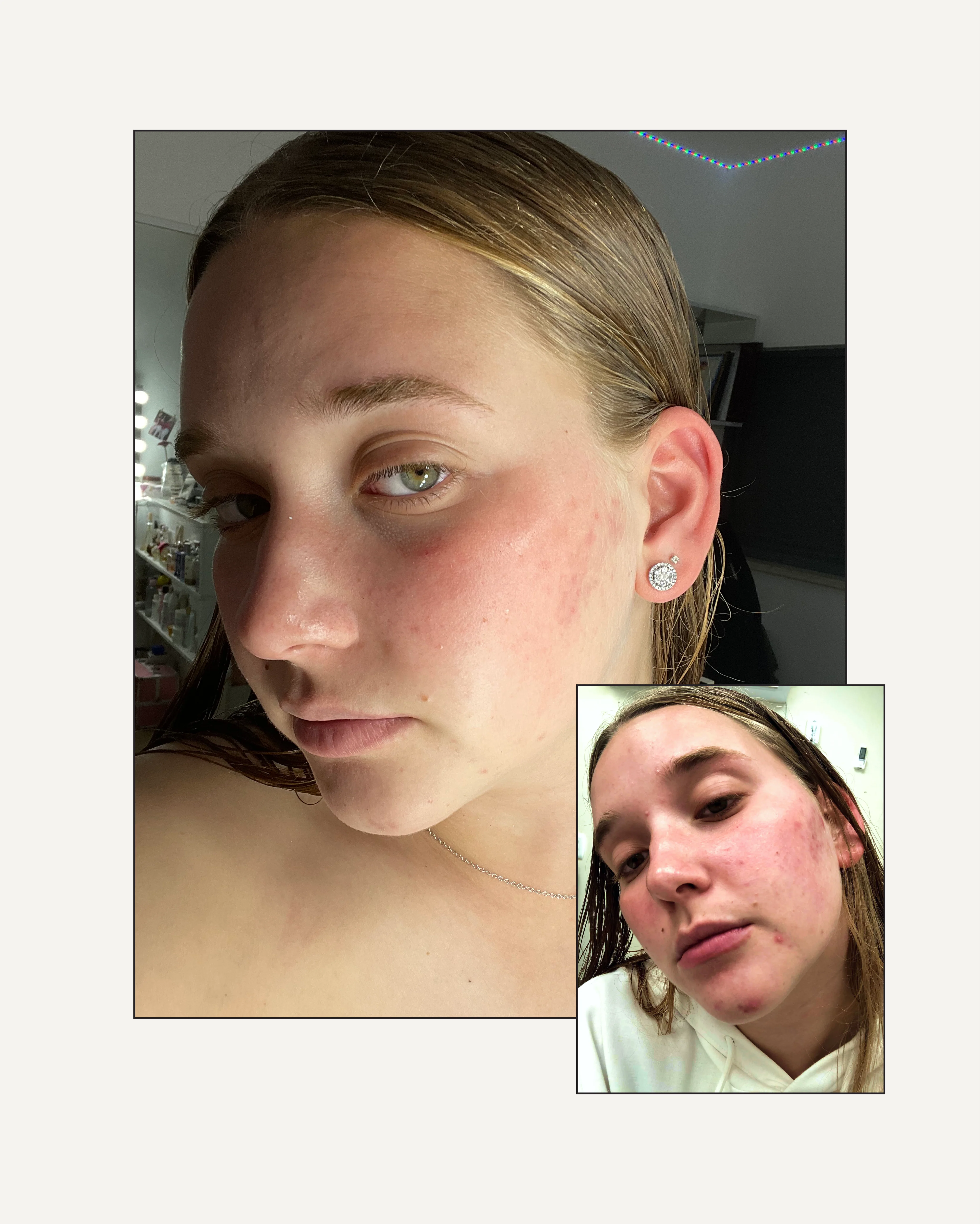 NO FILTER - Image 6